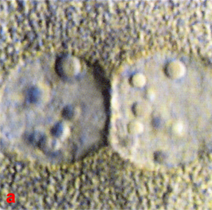 Close up view of pronuclei showing nucleolar distribution