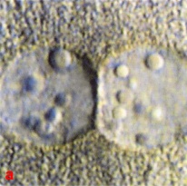 Close up view of pronuclei showing nucleolar distribution