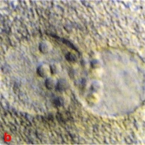 Close up view of pronuclei showing nucleolar distribution