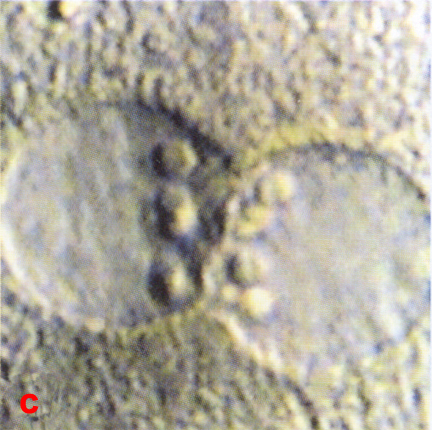 Close up view of pronuclei showing nucleolar distribution