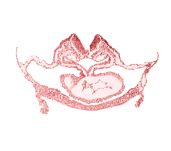 artifact separation(s), atrial canal, cephalic neuropore, dorsal aorta, foregut endoderm, foregut lumen, otic placode, presumptive left ventricle