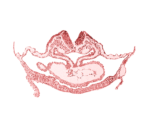 artifact separation(s), atrial canal, cardiac jelly, cephalic edge of hepatic plate, cephalic neuropore, dorsal aorta, otic placode, pericardial cavity, presumptive left ventricle, presumptive right atrium, primordial atrioventricular junction