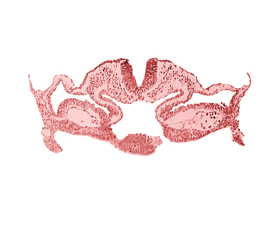 alar plate(s), basal plate, cephalic intestinal portal, dorsal aorta, head mesenchyme, hepatic plate / septum transversum region, neural fold [rhombencephalon (Rh. C)], notochordal plate, presumptive left atrium, presumptive right atrium, primordial pericardioperitoneal canal (pleural cavity), sulcus limitans