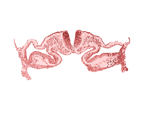 amnion attachment, amniotic cavity, artifact separation(s), midgut, presumptive right atrium, primordial pericardioperitoneal canal (pleural cavity), surface ectoderm, umbilical vesicle cavity