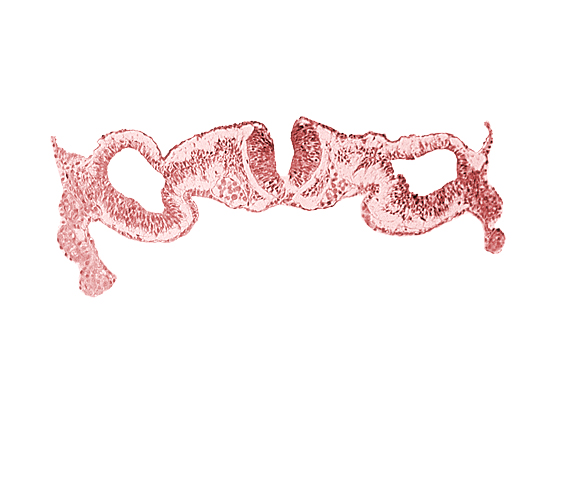 amnion attachment, dorsal aorta, dorsal intersegmental artery, midgut, neural fold [rhombencephalon (Rh. C)], primordial peritoneal cavity, sulcus limitans, surface ectoderm, umbilical vesicle wall