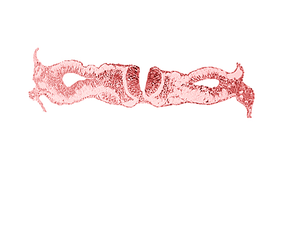 artifact separation(s), caudal end of somite 1 (O-1), dorsal aorta, neural fold [rhombencephalon (Rh. D)], primordial peritoneal cavity