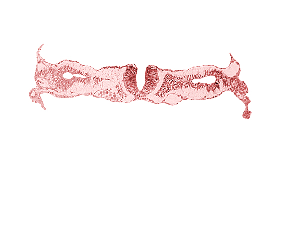 amnion, cephalic edge of somite 2 (O-2), dorsal aorta, midgut, neural fold [rhombencephalon (Rh. D)], primordial peritoneal cavity, right umbilical vein, umbilical vesicle wall