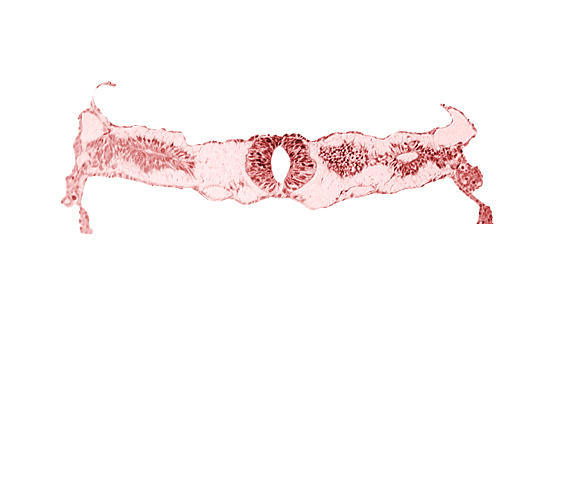 cephalic edge of neural tube, cephalic edge of somite 3 (O-3), fusing neural folds [rhombencephalon (Rh. D)], midgut, primordial peritoneal cavity, surface ectoderm