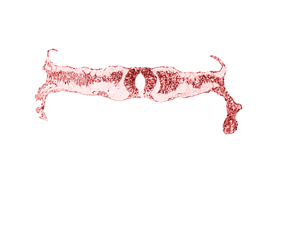 cephalic part of somite 4 (O-4), midgut, neural fold [rhombencephalon (Rh. D)], right umbilical vein