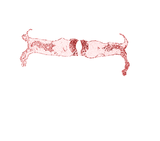 amnion attachment, dorsal aorta, midgut, neural fold (spinal cord), somite 4-5 intersegmental region, umbilical vesicle wall