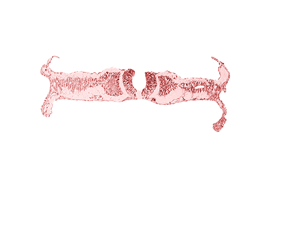 dorsal aorta, somite 5 (C-1)