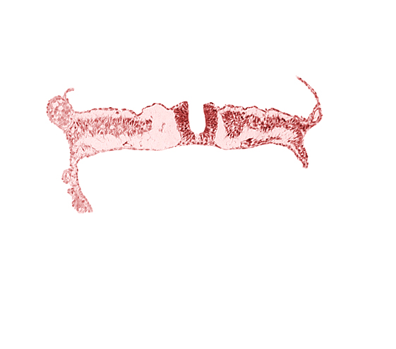 dorsal aorta, junction of neural ectoderm and surface ectoderm, lateral plate mesoderm, nephrogenic cord, neural fold, neural groove, notochordal plate, somite 7 (C-3), umbilical vesicle wall endoderm, umbilical vesicle wall mesoderm