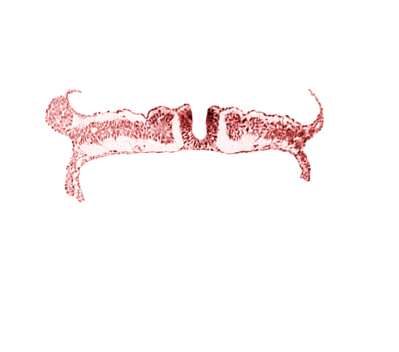 dorsal aorta, nephrogenic cord, somite 7 (C-3)