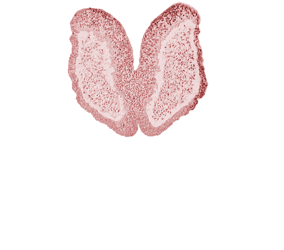 amniotic cavity, artifact space(s), chiasmatic plate (D1), head mesenchyme, junction of neural fold and surface ectoderm, maxillary prominence of pharyngeal arch 1, neural fold [primordial telencephalon medium (T)], surface ectoderm of head, terminal notch