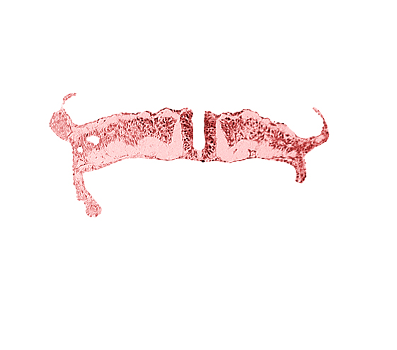 amnion attachment, amniotic cavity, dorsal aorta, neural fold, umbilical vesicle cavity, umbilical vesicle wall