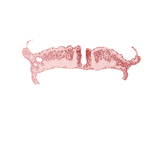 amniotic cavity, caudal neuropore, midgut, umbilical vesicle cavity