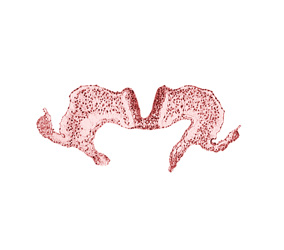amniotic cavity, caudal neuropore, midgut, primordial lateral body fold