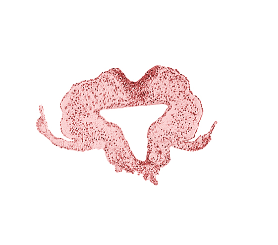 allantoic primordium, amnion attachment, amniotic cavity, extra-embryonic coelom, gastrulation (primitive) streak, hindgut, left umbilical vein, neural plate, primordial lateral body fold