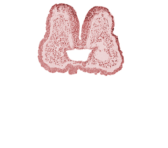 aortic arch 1, artifact space(s), cephalic edge of pharyngeal pouch 1, endoderm, foregut, mandibular prominence of pharyngeal arch 1, mesencephalic neural crest, neural fold [mesencephalon (M)], stomodeum