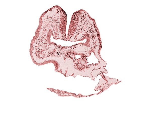 amnion, amnion attachment, aortic arch 1, cephalic neuropore, dorsal aorta, endoderm, facio-vestibulocochlear neural crest (CN VII and CN VIII), floor of foregut, head fold region, neural fold [rhombencephalon (Rh. A)], pericardial cavity, pharyngeal pouch 1, surface ectoderm