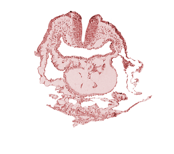 amnion, aortic arch 1, cephalic neuropore, conotruncus, dorsal aorta, head mesenchyme, neural fold [rhombencephalon (Rh. A)], pericardial cavity, pharyngeal pouch 1, pharyngeal pouch 1 endoderm: dorsal part, pharyngeal pouch 1 endoderm: ventral part