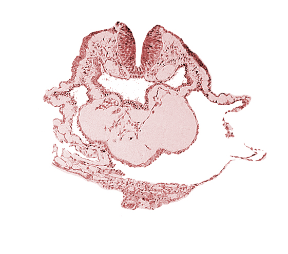 aortic arch 1, cardiac jelly, conotruncus, dorsal aorta, epimyocardium, lateral pharyngeal recess, left bulboventricular sulcus, neural fold [rhombencephalon (Rh. A)], pericardial cavity, thyroid gland primordium