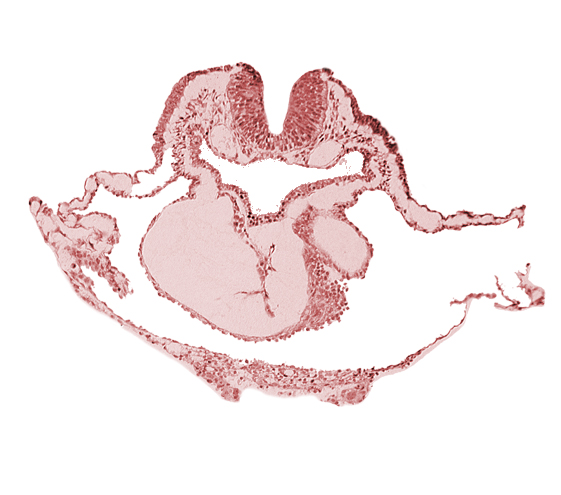artifact separation(s), bulbis cordis, dorsal aorta, lateral pharyngeal recess, left bulboventricular sulcus, neural fold [rhombencephalon (Rh. B)], notochordal plate, pericardial cavity, presumptive left ventricle, presumptive right ventricle