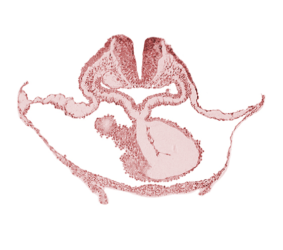 cephalic neuropore, epimyocardium, laryngotracheal sulcus, lateral pharyngeal recess, mesocardium, neural fold [rhombencephalon (Rh. B)], notochordal plate, otic placode, pericardial cavity, presumptive left ventricle