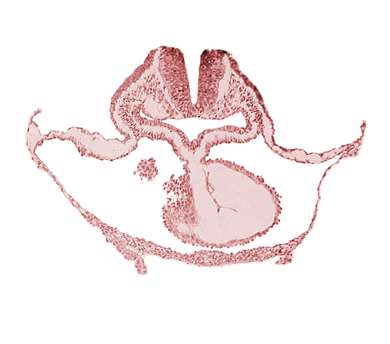 cephalic neuropore, epimyocardium, laryngotracheal sulcus, lateral pharyngeal recess, looped heart, mesocardium, neural fold [rhombencephalon (Rh. B)], notochordal plate, otic placode, pericardial cavity, pericardial sac, presumptive left ventricle