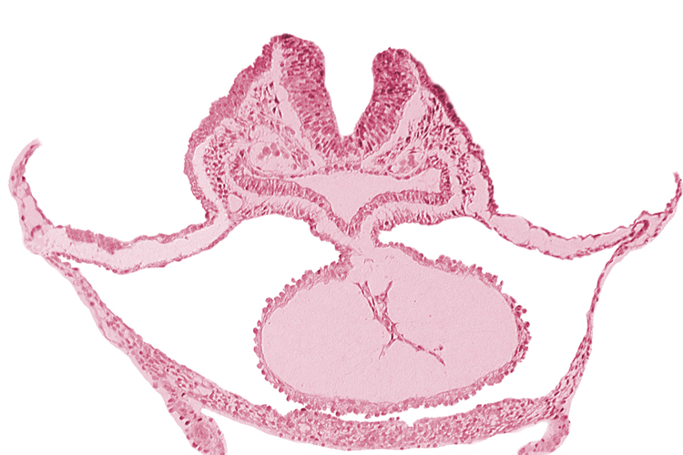 alar plate(s), basal plate, cardiac jelly, dorsal aorta, epimyocardium, laryngotracheal sulcus, neural fold [rhombencephalon (Rh. B)], otic placode, pericardial cavity, presumptive left ventricle, sulcus limitans