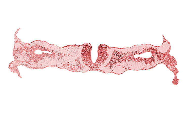 amnion, cephalic edge of somite 2 (O-2), dorsal aorta, midgut, neural fold [rhombencephalon (Rh. D)], primordial peritoneal cavity, right umbilical vein, umbilical vesicle wall