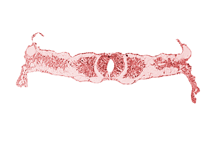 amnion attachment, dorsal aorta, endoderm, midgut, somite 3 (O-3), somitocoel 3, sulcus limitans, surface ectoderm, umbilical vesicle wall