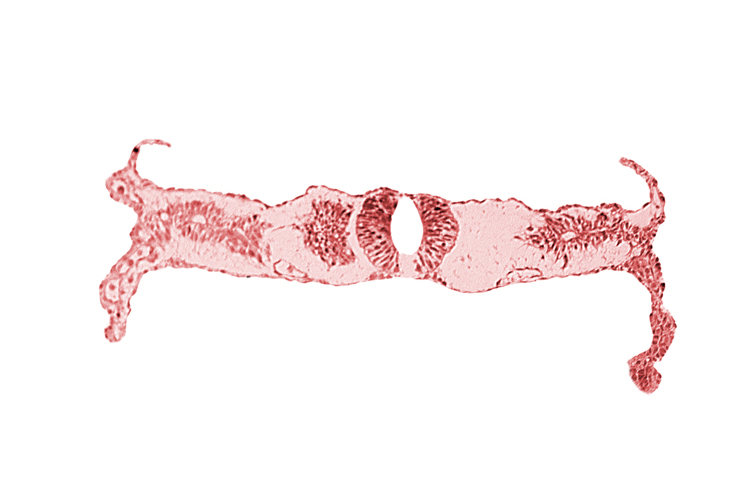 caudal edge of neural tube (junction of brain and spinal cord), fusing neural folds, primordial peritoneal cavity, right umbilical vein, somite 4-5 intersegmental region