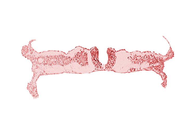 embryonic endoderm, embryonic surface ectoderm, right umbilical vein, somite 6-7 intersegmental region, umbilical vesicle wall endoderm, umbilical vesicle wall mesoderm