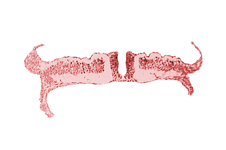 amnion attachment, amniotic cavity, caudal edge of somite 7 (C-3), caudal neuropore, endoderm, extra-embryonic coelom, extra-embryonic mesoderm, midgut, umbilical vesicle cavity, umbilical vesicle wall