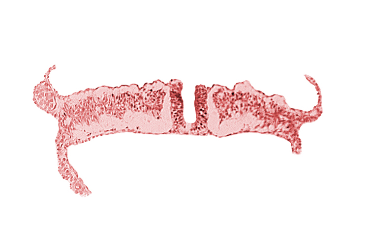 dorsal aorta, embryonic endoderm, embryonic surface ectoderm, extra-embryonic coelom, extra-embryonic ectoderm, extra-embryonic endoderm, extra-embryonic mesoderm, intermediate mesenchyme, lateral plate mesoderm, paraxial mesoderm, primordial peritoneal cavity