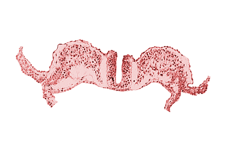 amnion ectoderm, amnion mesoderm, caudal neuropore, dorsal aorta plexus, extra-embryonic coelom, primordial lateral body fold, primordial peritoneal cavity