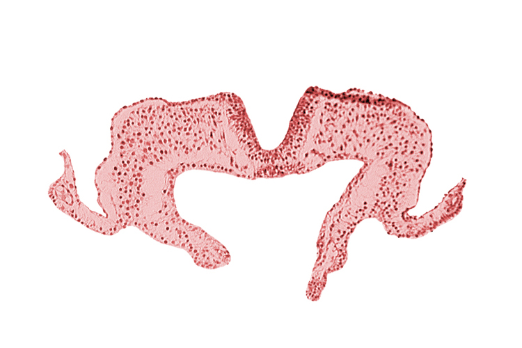 endoderm, mesoderm, midgut, neural fold, neural groove, notochordal plate, primordial lateral body fold, surface ectoderm