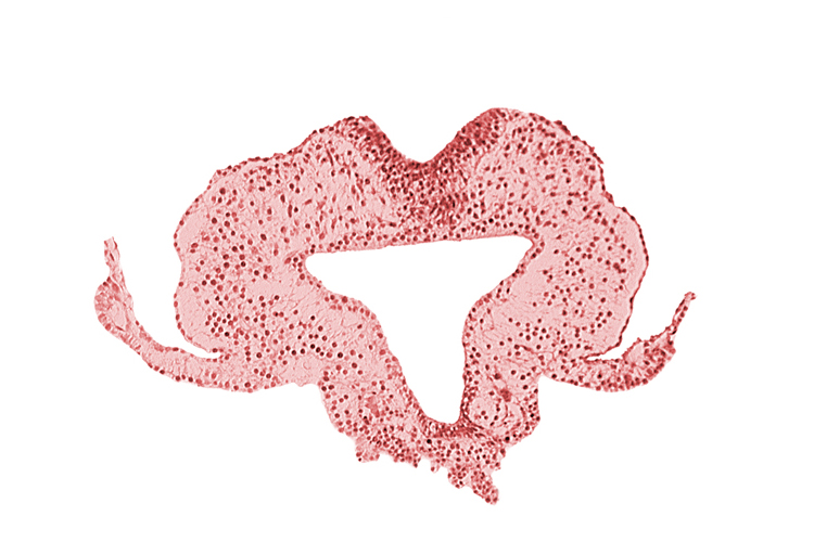 allantoic primordium, amnion attachment, amniotic cavity, extra-embryonic coelom, gastrulation (primitive) streak, hindgut, left umbilical vein, neural plate, primordial lateral body fold