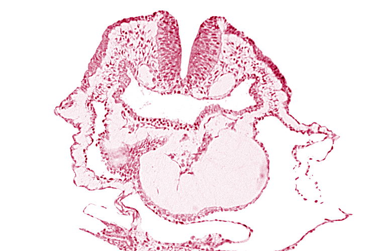 aortic arch 1, cardiac jelly, conotruncus, dorsal aorta, endocardium, head mesenchyme, junction of aortic arch 1 and primordial conotruncus, neural fold [rhombencephalon (Rh. A)], pericardial cavity