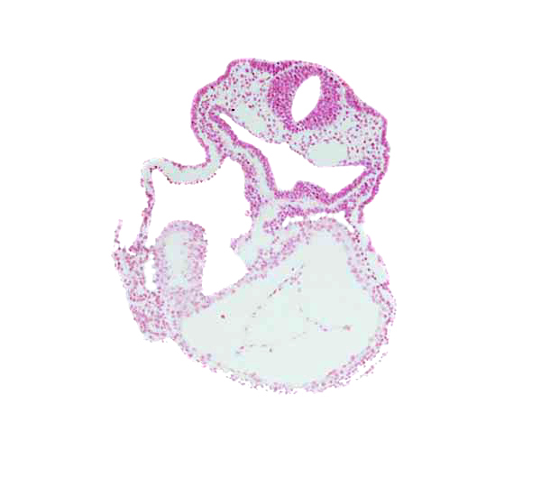 amnion attachment, cardiac jelly, caudal part of right ventricle (epimyocardium), foregut, laryngotracheal groove, lateral pharyngeal recess, left ventricle, otic placode, pericardial cavity, rhombencephalon (Rh. 5), surface ectoderm