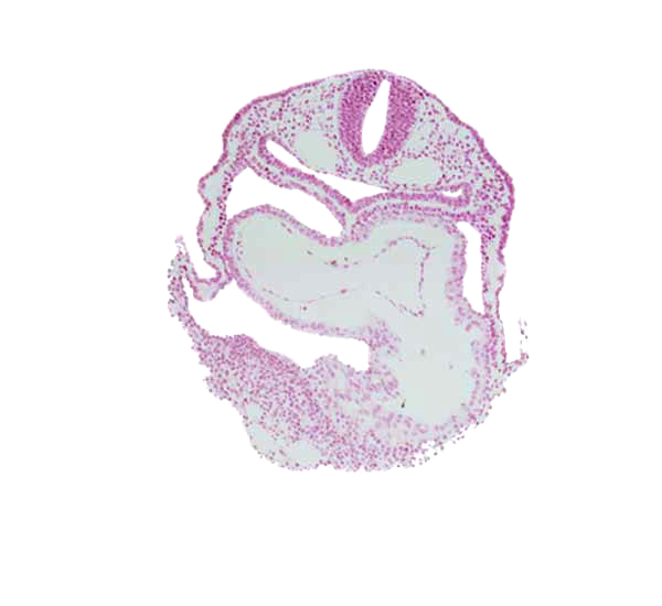 amnion attachment, caudal part of left ventricle, cephalic edge of interatrial foramen (primum), dorsal aorta, left atrium, mesocardium, pericardial cavity, rhombencephalon (Rh. 7), right atrium, vagal neural crest (CN X)