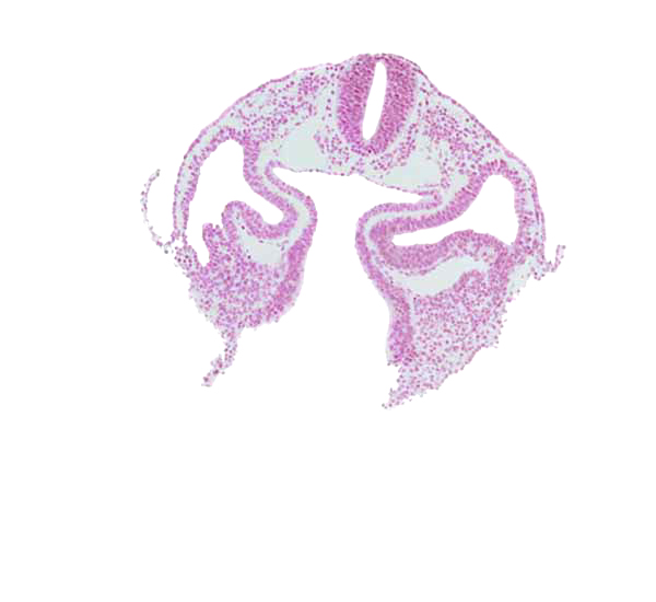 amnion attachment, cephalic edge of dermatomyotome 2 (O-2), dorsal aorta, dorsal intersegmental artery, junction of common cardinal veins, left horn of sinus venosus, midgut, notochord, pericardioperitoneal canal (pleural cavity), rhombencephalon (Rh. D), right horn of sinus venosus, sclerotome