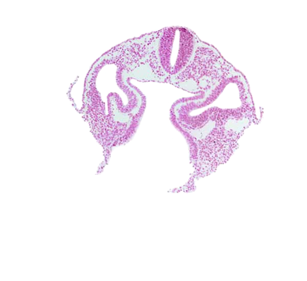 amnion attachment, dermatomyotome 2 (O-2) , left horn of sinus venosus, midgut, notochord, peritoneal cavity (coelom), postcardinal vein, rhombencephalon (Rh. D), sclerotome, umbilical vesicle wall