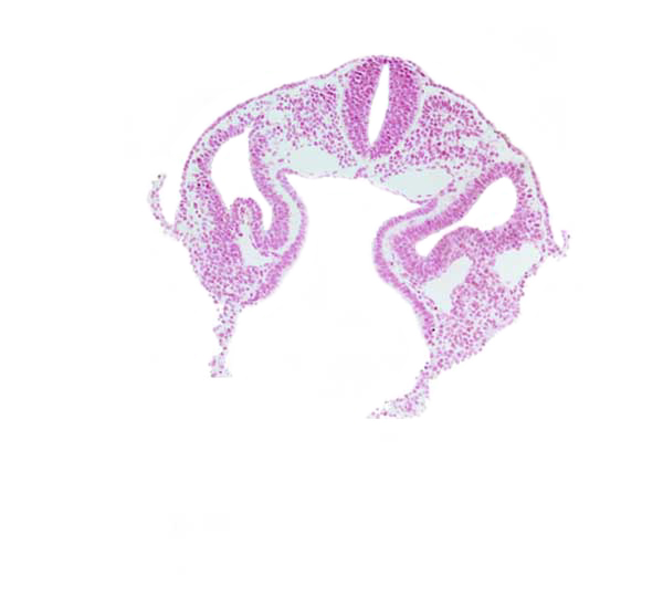 dermatomyotome 2 (O-2) , hypoglossal neural crest (CN XII), left horn of sinus venosus, midgut, notochord, postcardinal vein, rhombencephalon (Rh. D), sclerotome