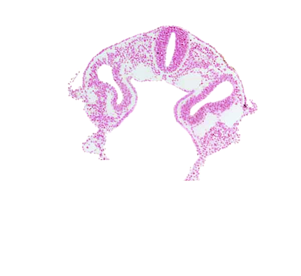 dermatomyotome 2 (O-2) , dorsal aorta, left horn of sinus venosus, midgut, notochord, peritoneal cavity (coelom), rhombencephalon (Rh. D), somitocoel 2, umbilical vesicle wall