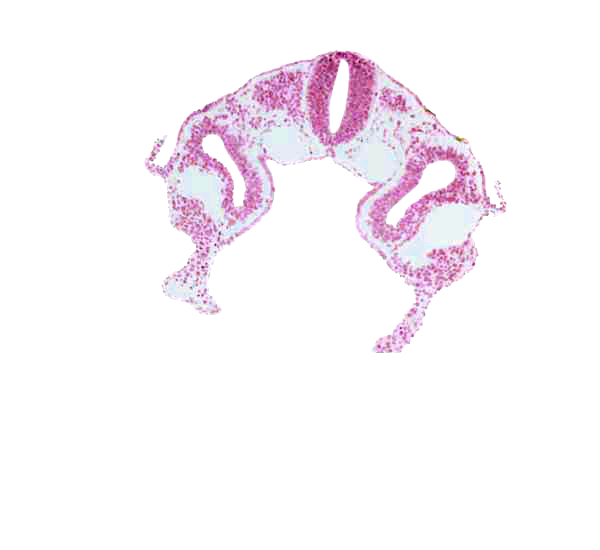 amniotic cavity, caudal edge of dermatomyotome 2 (O-2), dorsal intersegmental artery, left horn of sinus venosus, midgut, notochord, peritoneal cavity (coelom), postcardinal vein