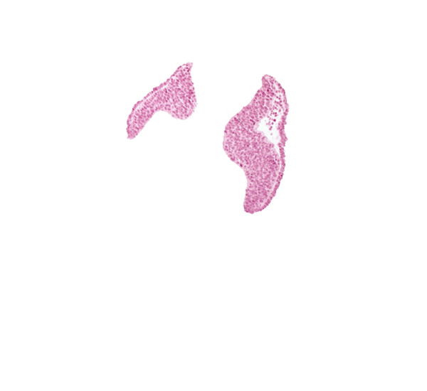 artifact space(s), cephalic neuropore, cephalic part of neural fold [diencephalon (D1)], junction of neural ectoderm and surface ectoderm, neural fold [diencephalon (D1)], neural fold [diencephalon (D2)], neural fold [mesencephalon (M)], optic nerve primordium (CN II) [diencephalon (D1)], optic sulcus, surface ectoderm