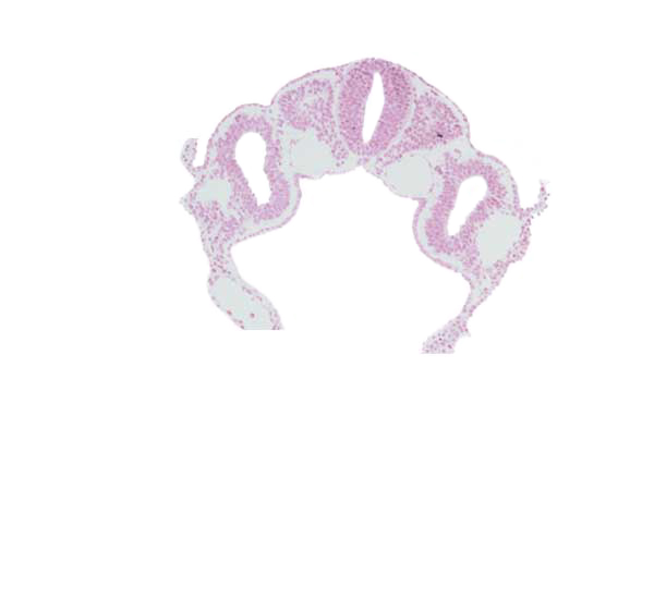 amniotic cavity, dermatomyotome 3 (O-3) , dorsal aorta, endoderm, left horn of sinus venosus, midgut, right vitelline (omphalomesenteric) vein, sclerotome, somatopleuric mesoderm, splanchnopleuric mesoderm