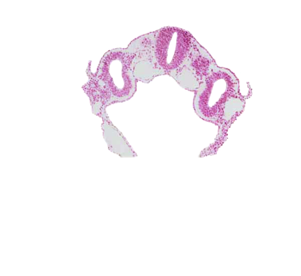 amnion attachment, caudal part of left horn of sinus venosus, cephalic edge of dermatomyotome 4 (O-4), dorsal aorta, midgut, neural tube, notochord